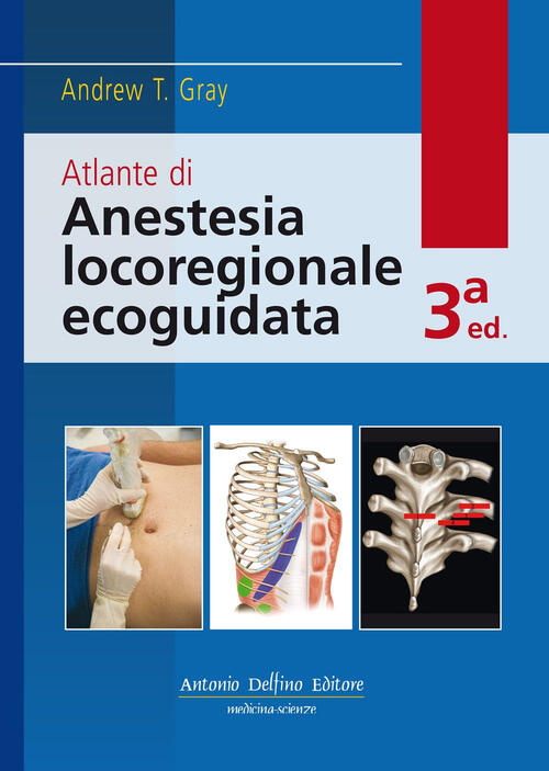 Atlante Di Anestesia Locoregionale Ecoguidata. Con Contenuto Digitale Per Down