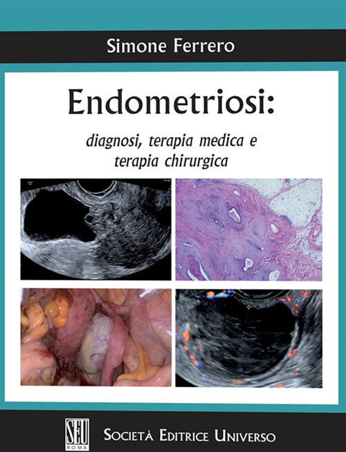 Endometriosi: Diagnosi, Terapia Medica E Terapia Chirurgica Simone Ferrero Seu