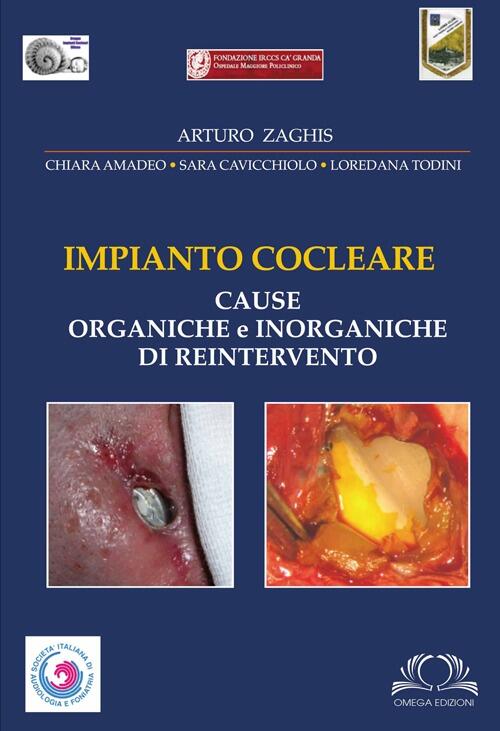 Impianto Cocleare. Cause Organiche E Inorganiche Di Reintervento Arturo Zaghis