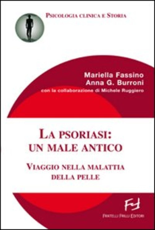 La Psoriasi: Un Male Antico. Viaggio Nella Malattia Della Pelle Mariella Fassi